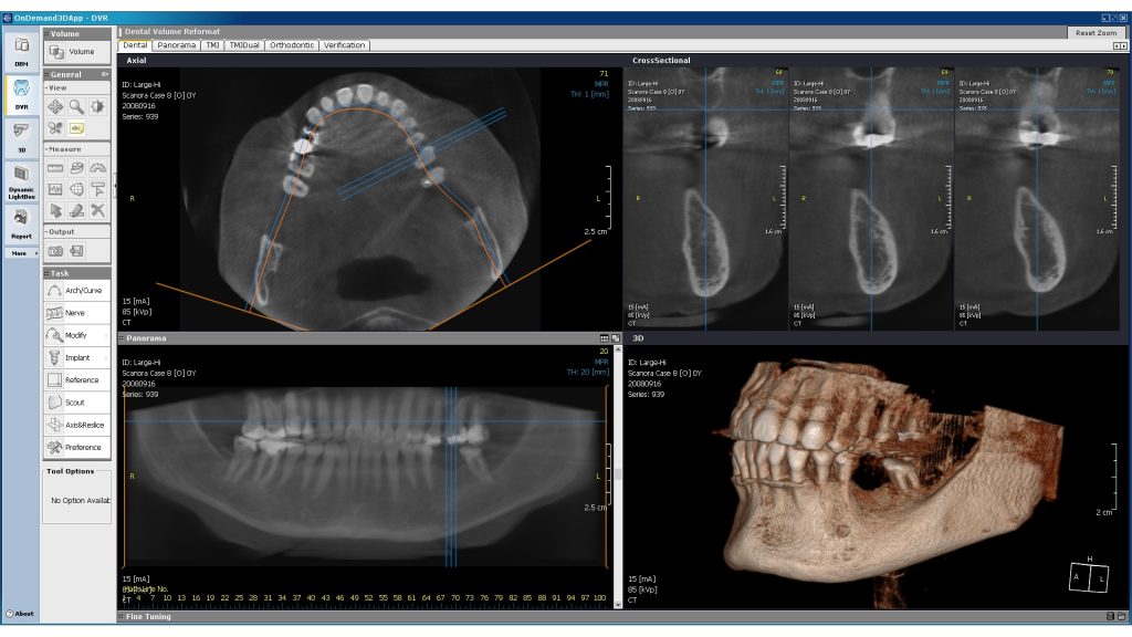 3d