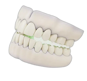 3d snimanje zuba vizual